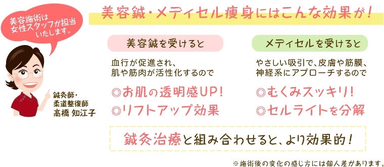 ���e�I�E���f�B�Z���̌���